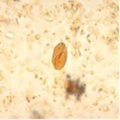 examen microscópico con lugol examen microscópico con lugol
